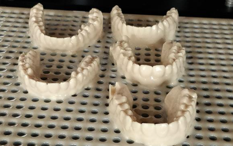 3d打印机应用到牙科领域会有什么好处？